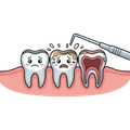 Teeth Cleaning