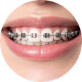 Orthodontics