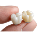 Porcelain Veneers