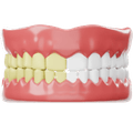 Teeth Whitening